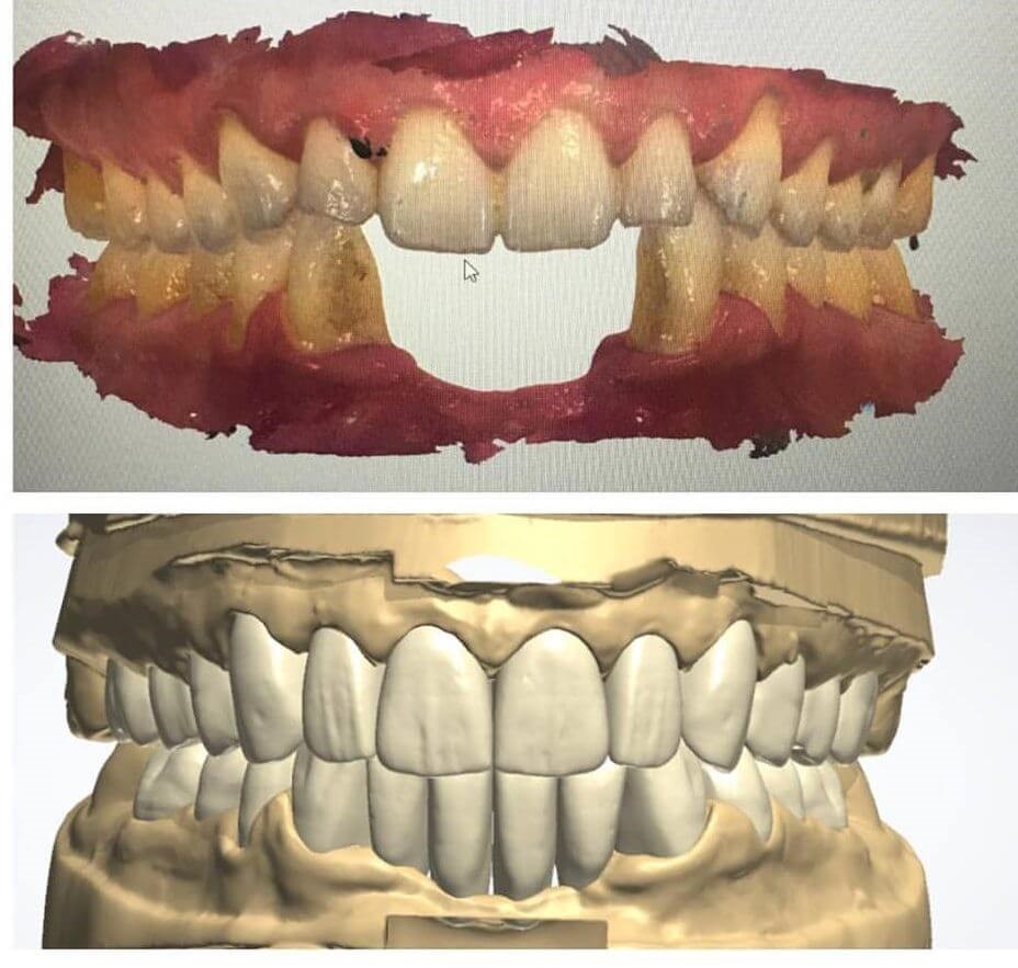 digital smile